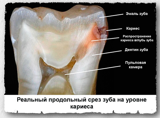 Признаки и симптомы