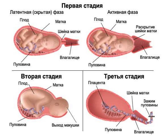 Стадии родов и схваток