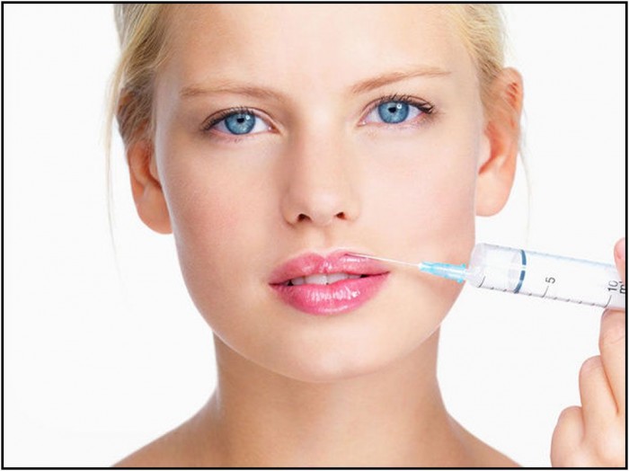 Collagen-Lip-Injections1