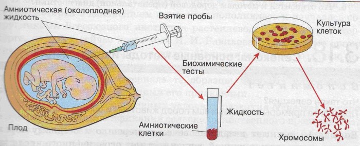 Исследования околоплодных вод при цитомегаловирусе