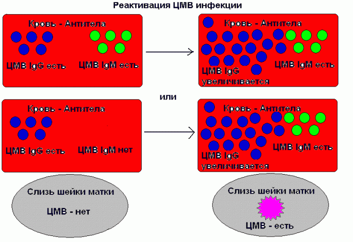 Реактивация цитомегаловируса