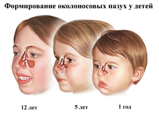 Гайморовы пазухи у детей разного возраста.