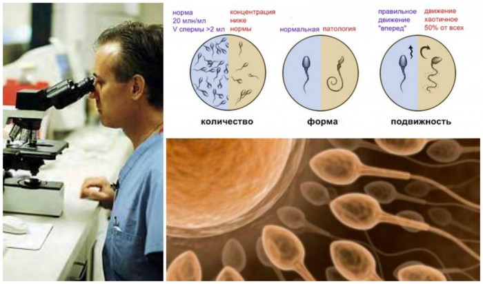 Нормозооспермия