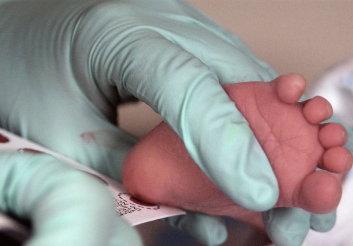 Анализ из пятки новорожденного берут через несколько суток после рождения, чтобы выявить возможные генетические отклонения.