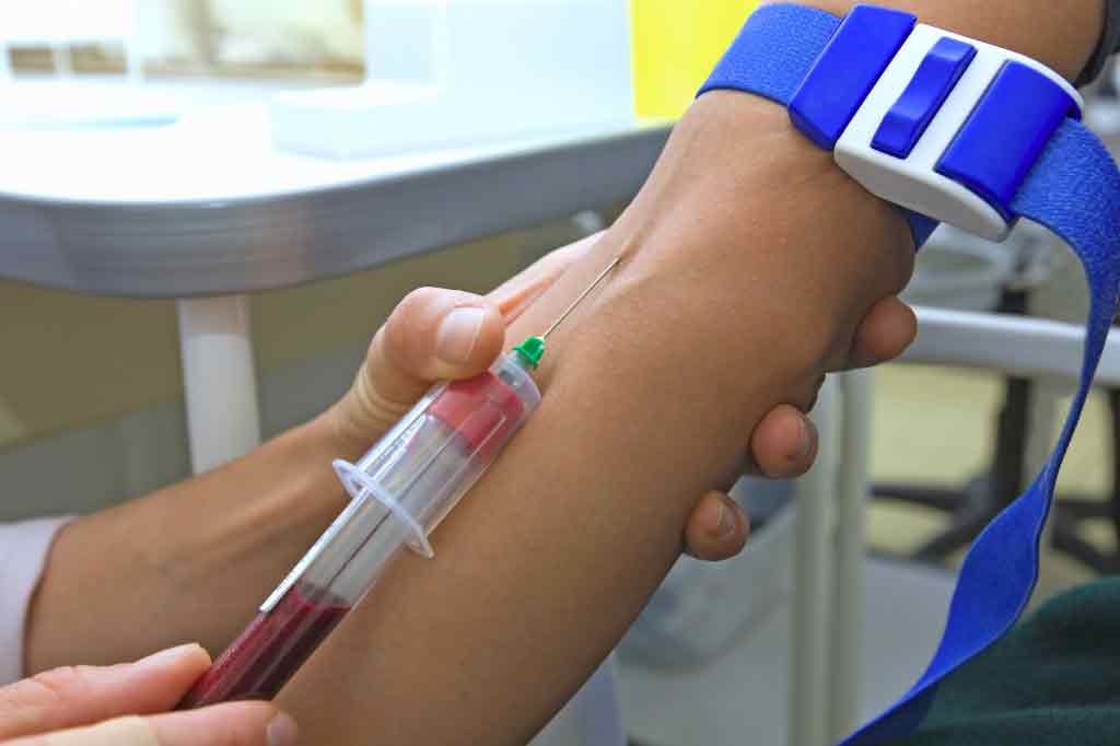 забор крови на сифилис при бытовом заражении