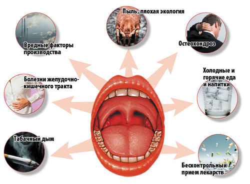 El desarrollo de factores de amigdalitis.