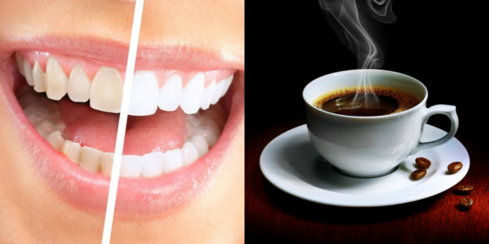 El café es una bebida capaz de pintar sus dientes en amarillo.