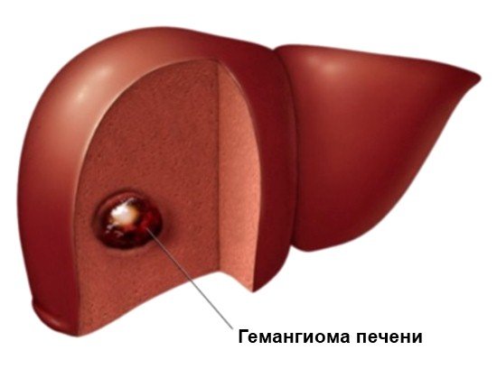 22587711-lechenie-gepatita-chastnaya-klinika