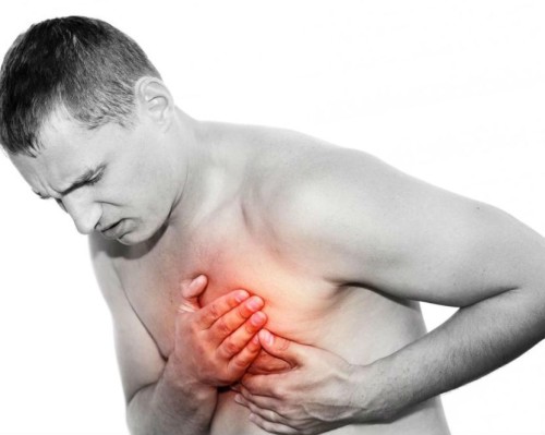 При инфаркте боль иррадиирует во всю левую половину туловища.