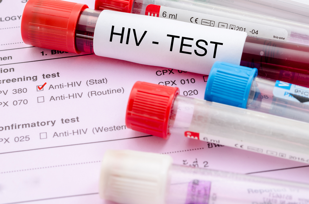 Как определить ВИЧ по общему анализу крови?