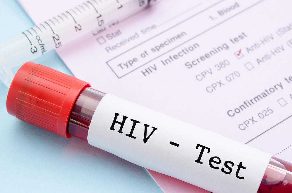 Симптомы и первые признаки ВИЧ у женщин, мужчин и детей на ранних стадиях