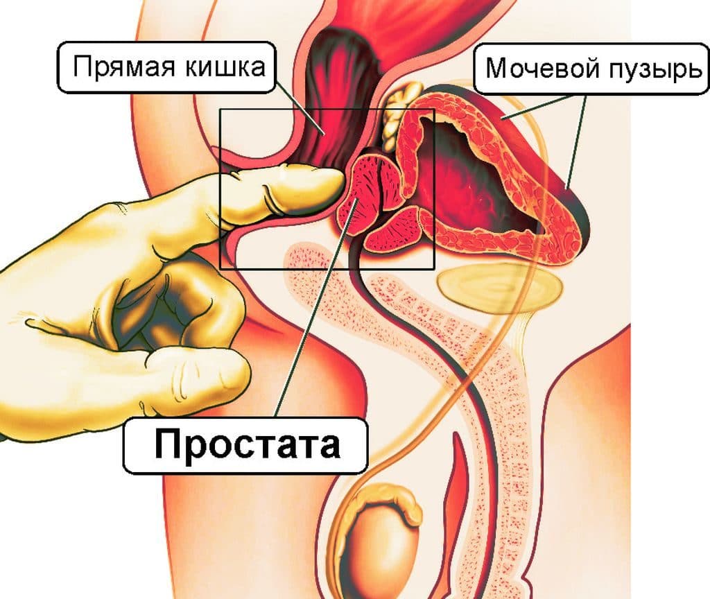 Картинки по запросу массажа простаты