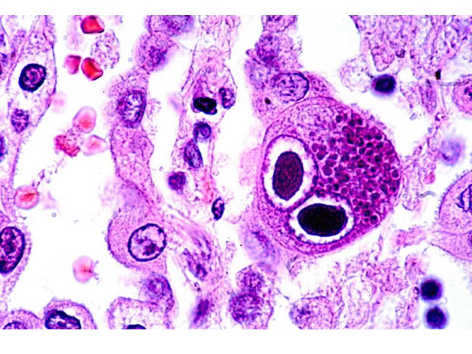 tsitomegalovirus-molekula