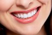 Неправильный прикус у взрослых. Как выровнять зубы? Выравнивание зубов брекетами, каппой: фото до и после. Исправление прикуса без брекетов