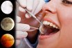 ปฏิทินจันทรคติของการรักษา, ขาเทียม, การกำจัด, การทำความสะอาด, การฟอกสีและการปลูกถ่ายฟันสำหรับ 2021-2022: วันที่ดีสำหรับทุกเดือน เมื่อมันจะดีกว่าการรักษา prosthet และฟันลบเกี่ยวกับปฏิทินจันทรคติใน 2021-2022?